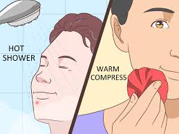 We did not find results for: 4 Ways To Get Rid Of A Pimple Wikihow