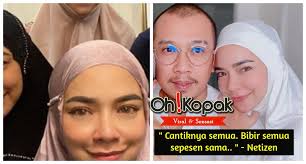 Korang pernah tengok tak nora danish berlakon selekeh macam ni. Cantiknya Semua Bibir Semua Sepesen Sama Netizen Oh Kopak