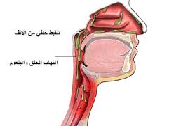 تنقيط أنفي خلفي ويكيبيديا