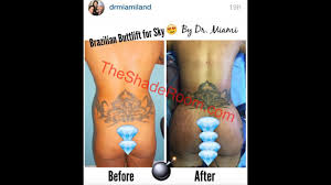 Sky From Black Ink Crew Posted Pictures Of Her New Butt On Instragram Youtube