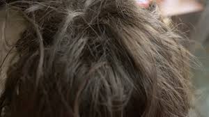 Although less common, head lice can spread by personal contact or the sharing of combs, brushes, caps, and other clothing. Girl Lice Stock Video Footage 4k And Hd Video Clips Shutterstock