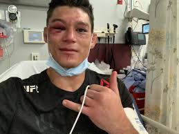 Alan Jouban