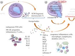 Inflammation In Intervertebral Disc Degeneration And Regeneration Journal Of The Royal Society Interface