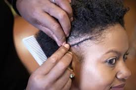 How To Grow Back A Damaged Hairline Breaking Hair Natural Hair Styles Hair Problems
