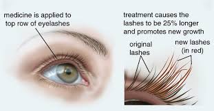 Only apply at base of upper lashes. Latisse Eyelash Growth Treatment In Fresno Madera Ca