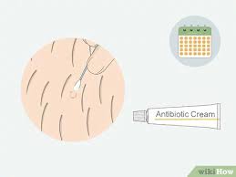 How To Get Rid Of Ingrown Pubic Hair With Pictures Wikihow