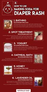 Yeast treatment is available over the counter. Milenium Home Tips Baking Soda Diaper Rash