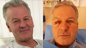 Dead' kangaroo springs to life, leaves man needing eye surgery