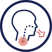 Roughly 21,000 women a year are diagnosed with ovarian ca. Mesothelioma Symptoms Top Warning Signs For Mesothelioma