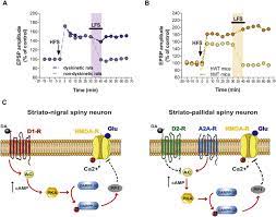 Dystonia And Levodopa Induced Dyskinesias In Parkinson S Disease Is There A Connection Sciencedirect
