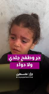 أجساد الصغار في غزة تنزف من الطفح، والدواء غائب، والصمت يقتل, تصوير:  jemo__faisal, #رؤيا_فلسطين