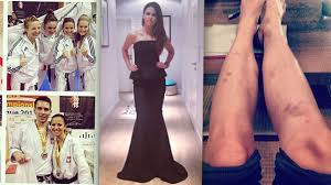 1020 x 680 jpeg 36kb. Anna Lewandowska Mistrzynia Swiata W Karate Dumny Maz Natychmiast Zlozyl Gratulacje Eurosport W Tvn24