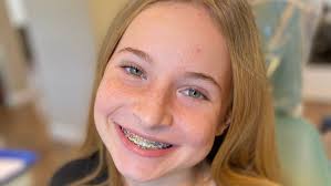 Smile Stylishly: Embracing the Trendy World of Orthodontics — Top  Orthodontist in Fredericksburg & Stafford