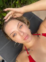 Started my hormone kit today to help with hormonal acne