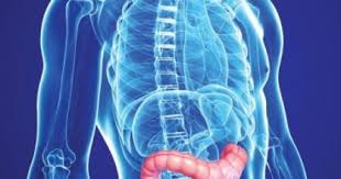 Scopul acestor conferinte este de a determina modalitatea optima de tratament pentru fiecare pacient cu cancer de colon sau rect. Gral Medical Tratament Cancer Colon Sigmoid In Sectia De Chimioterapie Prezentare Caz