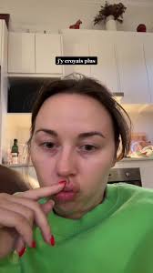 #trickstervoice 😂😭