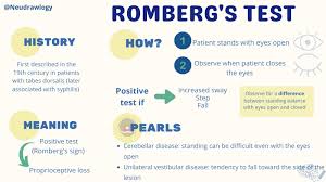 Image result for Romberg Test