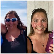 Keto diet success story after gastric sleeve