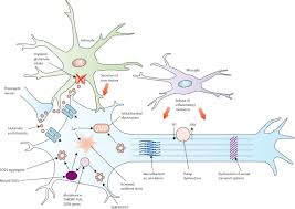 Amyotrophic Lateral Sclerosis The Lancet