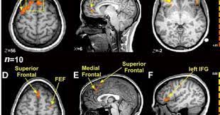 A lie detector machine is not accurate in detecting lies, just in measuring reactions. The Creativity Post Controversial Science Of Brain Imaging