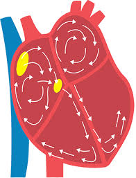 Image result for Atrial Fibrillation