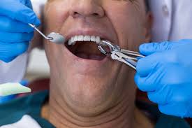 Best care dental specializes in beautifying smiles, maintaining your dental health, and helping you improve your appearance. Santa Paula Dentists Santa Paula Dentists