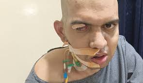 My Brother Is Suffering From Brain Fungal Infection. We Need Y Koour Help  To Provide For His Treatment