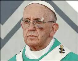 Pope suffers black eye from popemobile ...