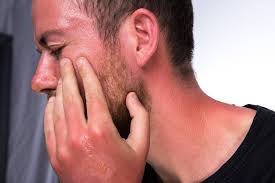 Jika ditangani dengan tepat, keluhan tersebut pada umumnya bisa membaik saat kulit anda berjuang melawan kerusakan akibat sinar matahari, ia membutuhkan kelembapan yang hilang selama anda berada di bawah. Luka Terbakar Matahari Sunburn Keparahan Mengatasi