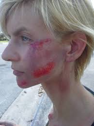 The Growing Pains of an Evolving Transportation Culture: Doored to the  Floor »