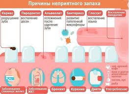 Nepriyatnyj Zapah Izo Rta Prichiny Razvitiya Galitoza Metody Opredeleniya Patologii V Domashnih Usloviyah Lechenie Aptechnymi Preparatami I Narodnymi Sredstvami