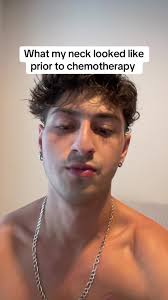 Hodgkins Lymphoma Lump