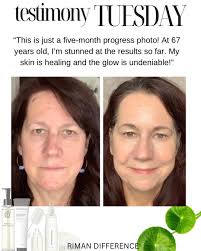 These testimonials keep rolling in—and they're AMAZING! 🙌 ✨ Latest KBeauty  Testimonial: “I've been using the EX line since April 28th, and I'm already  seeing subtle changes in my marionette lines. The