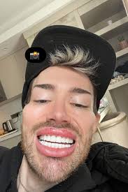 Have fun doing this every 10 years': Man leaves TikTok users shocked  getting BUDGET teeth shaving in Turkey