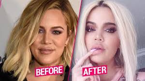 Khloe kardashian sent the internet in a frenzy when she shared unrecognizable photos of herself on her what do you think about khloe kardashian's before and after photos and her changing face? Khloe Kardashian S Plastic Surgery Makeover After Split