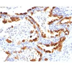 When image size matters, you often have to compromise with quality. Anti Cytokeratin 18 Antibody C 04 A86656 Antibodies Com