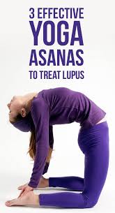 3 Effective Yoga Asanas To Treat Lupus Yoga Asanas Yoga Poses Treat Kidney Stones