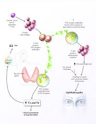 Book doctor appointment consult doctor online. Diagnosis And Management Of Graves Disease Cmaj