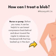 ➡️What is a milk blister? ✨A milk blister, or blocked nipple pore, is also  called a bleb or nipple blister, or simply “milk under the skin.” It occurs  when a tiny bit