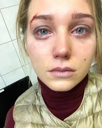 Кристина асмус на костылях рассказала о новом. Strashno Za Doch Asmus Uvezla Rebenka Ot Sadista Harlamova V Sochi