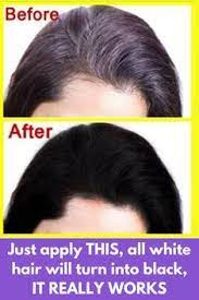 Just Apply This And In 1 Use All White Hair Will Turn Into Black It Really Works Most Common Problems Rel How To Darken Hair Grey Hair Diy Premature Grey Hair