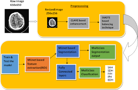 Image result for Hemorrhage Classification