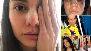 Mánager de Eileen Moreno y Alejandro García da su versión