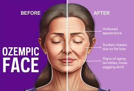 Cosmetic Appearance Concerns