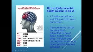 Webinars Bianj Is a brain aneurysm causing your excruciating headache?