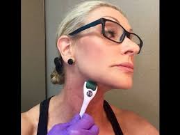 The Problem With Neck Acne Pimples On Jawline Won T Go Away Rodanandfieds Neck Read More Info By Clicking Th Tighten Neck Skin Sagging Neck Skin Neck Acne