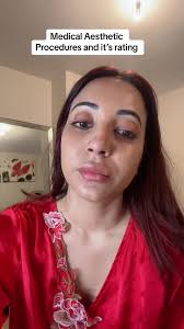 mauritian #moris #medicalaesthetics #fyp #mauritius #fypシ #canada #vi...