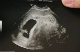 Metodo Ramzi Aiuto Discussione Periodofertile It