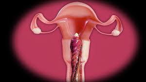 Tifas perfect pussy filled (X-ray version)