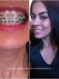 Reviews of Scarborough Town Orthodontics in Toronto, ON